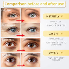 NAZANO parches ojos oro 24k: textura suave para piel delicada