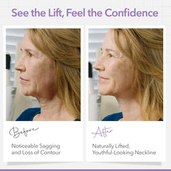 NECK LESS strips applied to neck area for defined contour