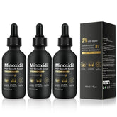 NETYIYUN Minoxidil for Women bottle targets thinning scalp areas