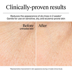 Neutrogena Hydro Boost para piel normal a seca, crema en gel de acabado suave.