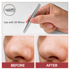 NILIYA Eyebrow Tweezers two-in-one design for brows and blackhead removal.