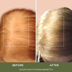 NOOR HAIR nutrition label closeup highlighting key vitamins for follicles