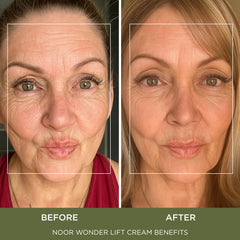 Noor Hair Syn-Ake ingredient blend bottle highlights key actives.