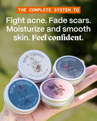 Norse Organics Pimples 2.0 Night Balm jar, overnight nourishment for calmer skin.