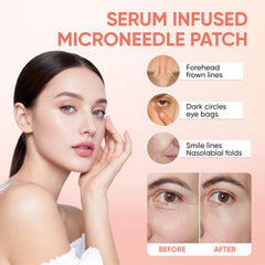NOVALIFT MicroGlow Eye Patches applied under-eye to reduce puffiness.