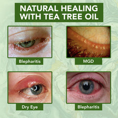 NOVEHA crema ojos antiarrugas mejora elasticidad y suaviza lineas finas.