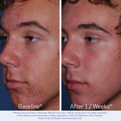 Close-up of Obagi CLENZIderm M.D. Pore Therapy texture for exfoliation.