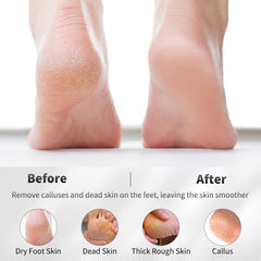 ÖkoStamm conical pumice set targeting hard-to-reach foot areas