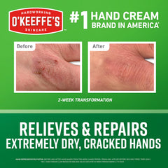 Close-up of cracked hands highlighting dryness before treatment with O'Keeffe's Working Hands