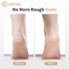 Orivibe dual rollers close-up showing fine and coarse textures for exfoliation