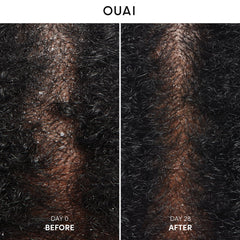 OUAI shampoo lather demonstrates gentle cleansing for irritated scalps.