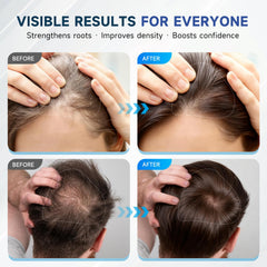 OVEXLIO rosemary leaves highlight the natural root-supporting formula for healthier-looking roots.