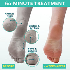 Patchology PoshPeel Pedi Cure: aplicación para pies, resultado suave tras la sesión