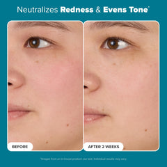 Label detail on Paula's Choice Skin Balancing Toner highlighting fragrance-free formula