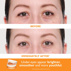 Peter Thomas Roth Water Drench Hydra-Gel Eye Patches close-up highlights gel texture.