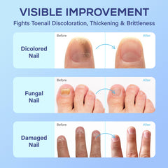 PHARMBANNER packaging shows an all-in-one nail care solution.