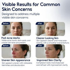 Pharmlitalia Azelaic Acid 15 cream swirl for even tone
