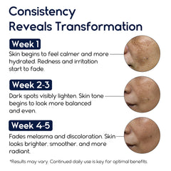 Pharmlitalia Meladerm face cream swirl demonstrates easy spreading for even coverage