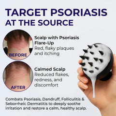 Pharmlitalia psoriasis shampoo label highlighting antifungal and anti dandruff benefits