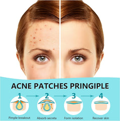 Parche hidrocoloide PICcircuit con adhesión fuerte para dormir toda la noche sin irritación