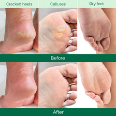 PLANTIFIQUE Foot Peeling Mask 2 Pack male user showing unisex fit.
