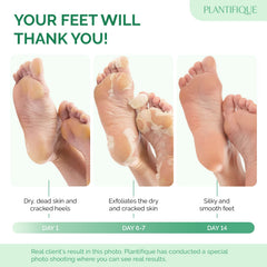 PLANTIFIQUE mascarilla aplicada en los pies para exfoliación suave