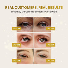 Envase práctico de PLANTIFIQUE con parches ojos 24K para uso diario.