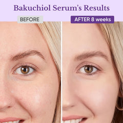 +1HEROLABS Bakuchiol Serum ingredientes botánicos promueven regeneración celular.