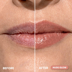 PrimePrometics PrimeLip with twist cap for precise, easy lip shaping.