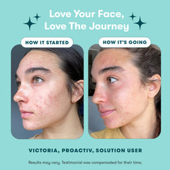Proactiv Repairing Treatment targeting a blemish for focused care