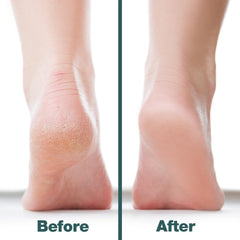 Probelle foot file handle design offers a comfortable grip during use.