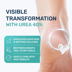 PROJECT 701 exfoliación de pies con urea 40% para suavizar durezas