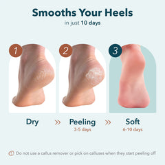 Purederm Heel Mask essence absorption highlights nourishing hydration.