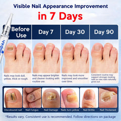 PureSynth nail fungus pen precision tip ready for daily use
