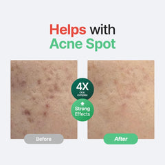 Purito Centella sin fragancia: textura ligera para absorción rápida.