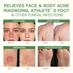 QualiLife aplicación facial, uso suave para piel sensible.