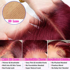 QZOQZO glueless-cap view emphasizing secure fit and comfortable wear.