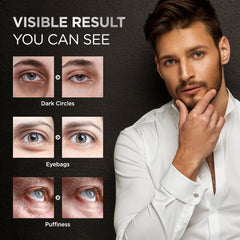 RAZONIX tratamiento bolsas ojos: reduce hinchazón y apariencia cansada.