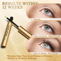 Recuren Plus aloe ferox juice image suggests soothing lash care.