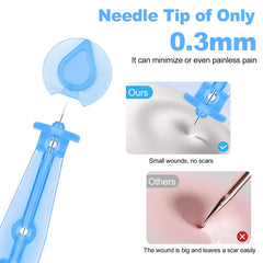 Refesta ultrafine 0.3mm needle tip enables precise blackhead removal