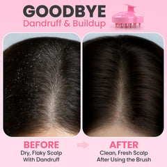 RELAXXO scalp massager used with shampoo in the shower for thorough cleansing