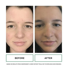 Replenix Gly-Sal wet face rinse demo illustrates easy cleansing and routine prep