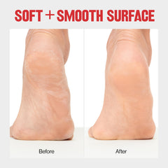 Revlon Pedicure Tools ergonomic handle ensures comfortable grip during use