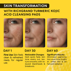 RICHGRAND disco exfoliante suave para textura más lisa