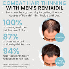 Rida Hair Growth Vitamins capsule closeup highlights potent formula for faster regrowth