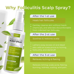 Rida Folliculitis Scalp Spray applied to scalp with soothing relief emphasis