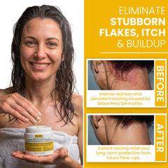 Rida scalp scrub being applied, showing foamy lather and even distribution.