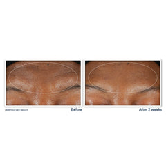 Desmaquillante RoC Retinol Correxion para rostro y ojos con maquillaje resistente