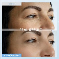RONKIE crema de ojos retinol, dosis nocturna para cuidado constante.