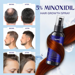 RootStim minoxidil 5percent scalp application on clean hair for targeted treatment